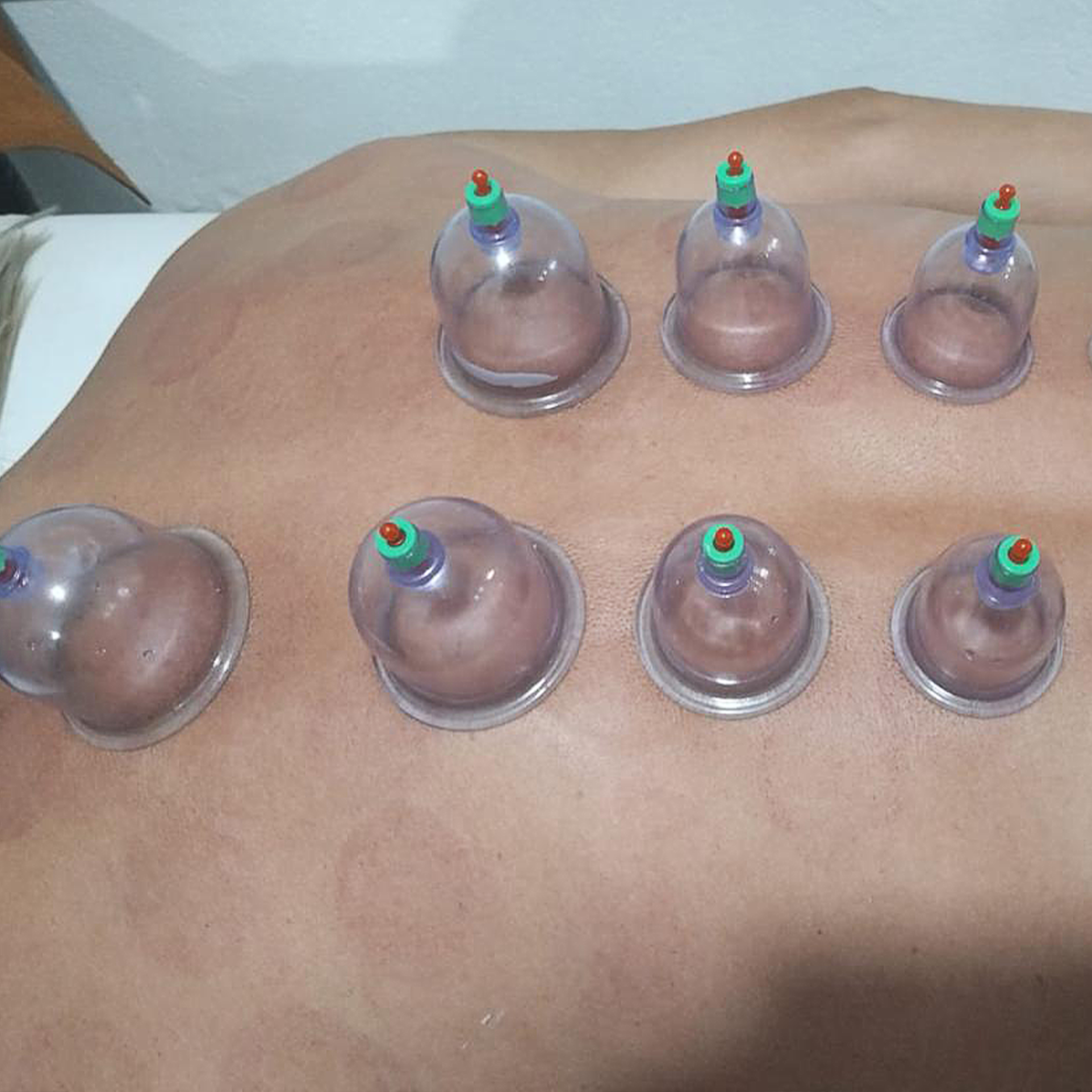 Procedimento Corporal e Bem-estar