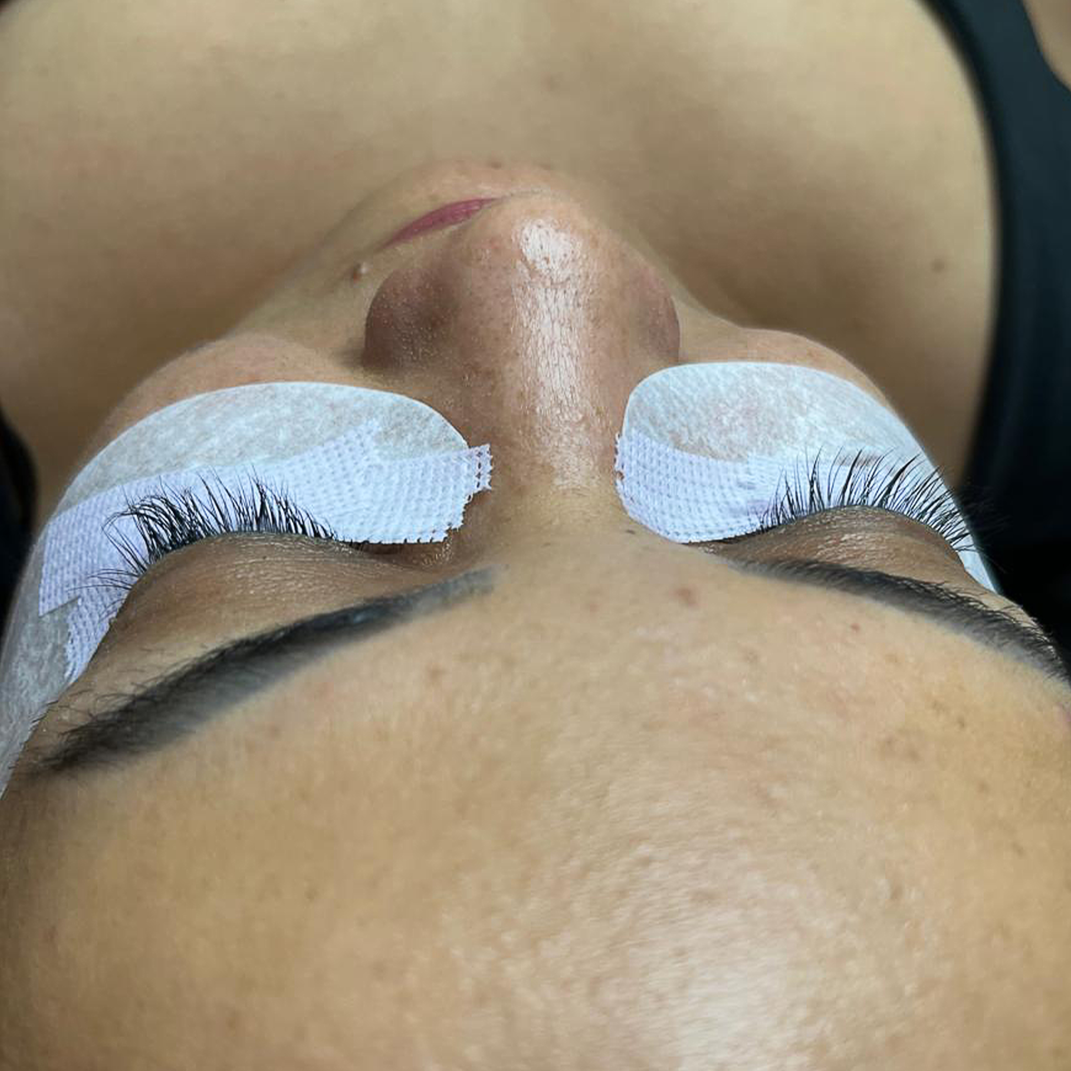 Procedimento Facial e Beleza